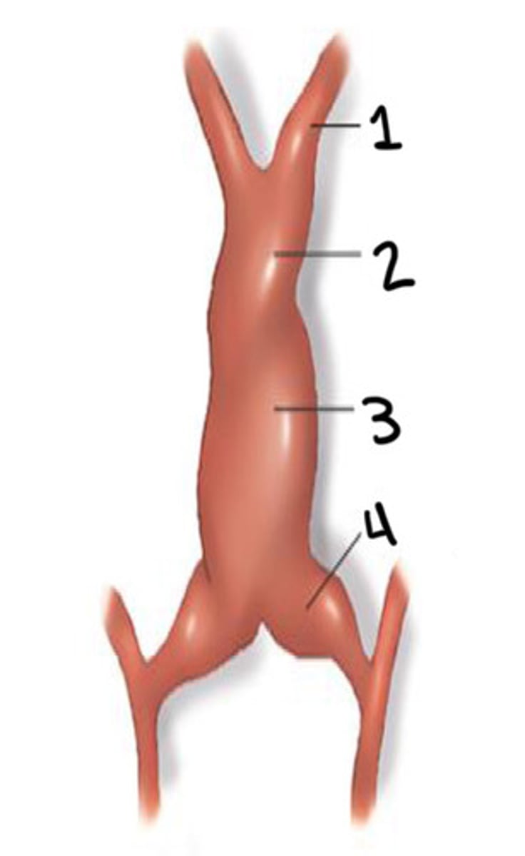 <p>What is 4</p>