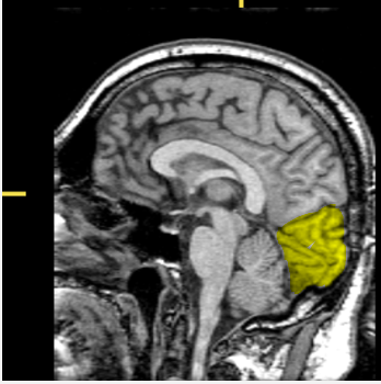 <p>What part of the brain is highlighted?</p>