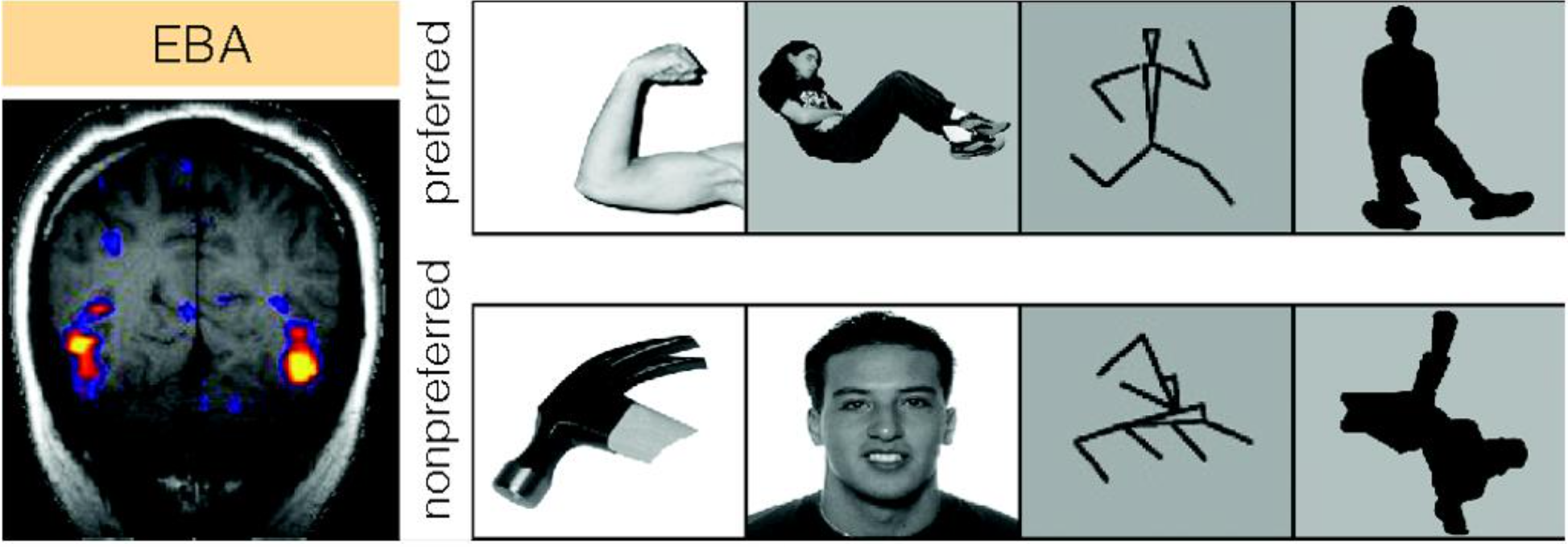 <p><strong>EXTRASTRIATE BODY AREA (EBA)</strong></p>
