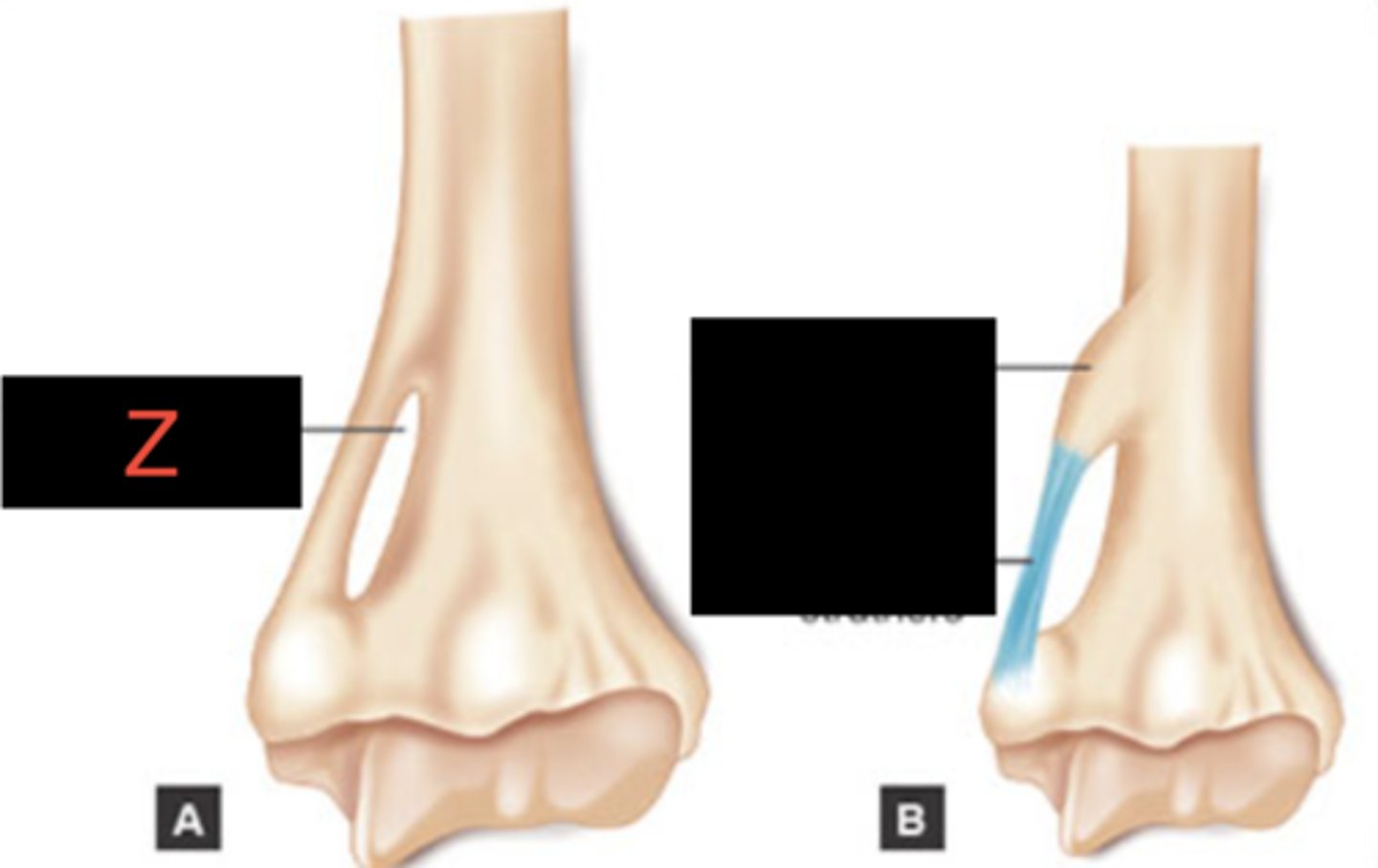 <p>What structure is labeled as Z in this picture of the medial, distal part of the humerus of the cat?</p>