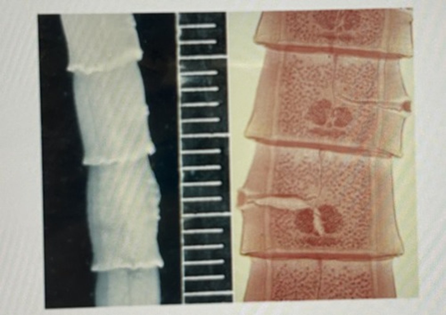 <p>The intermediate proglottids or mature proglottids contain :</p>