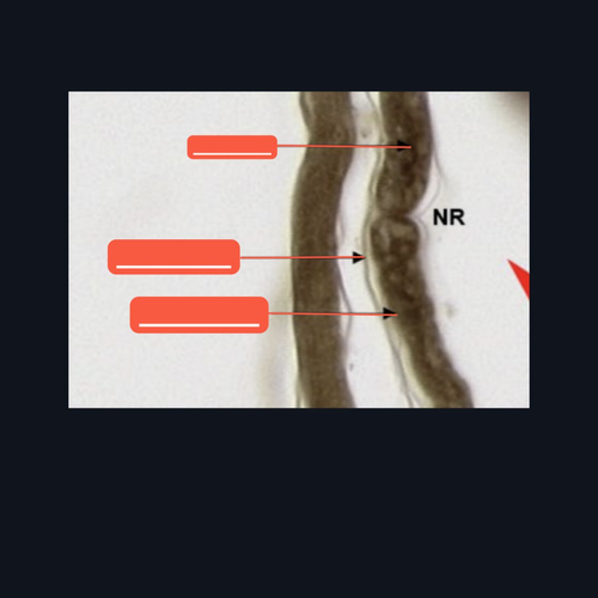 <p>Identify the pointed structures.</p>