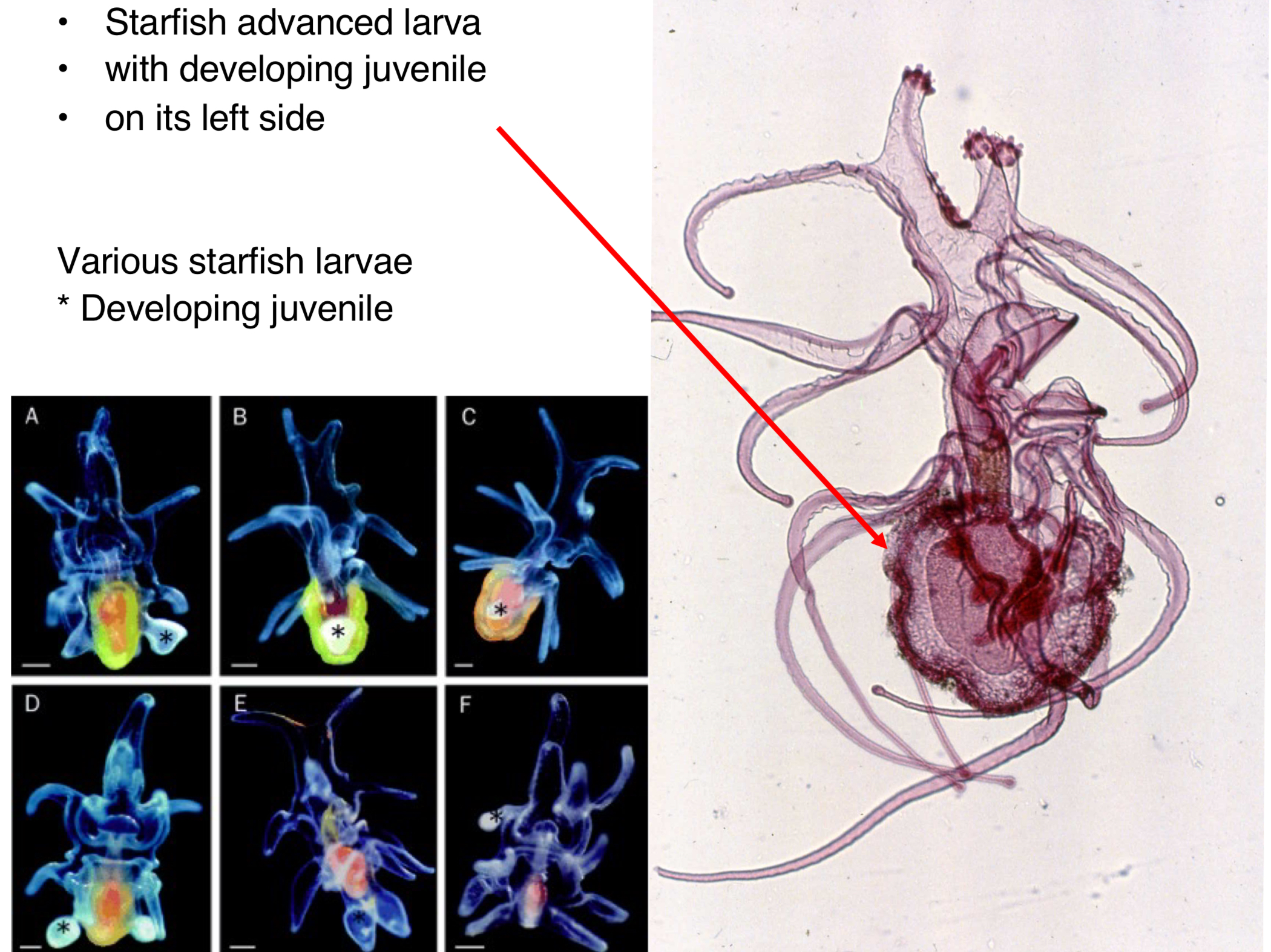 <p>Starfish advanced larva with developing juvenile on left side</p>