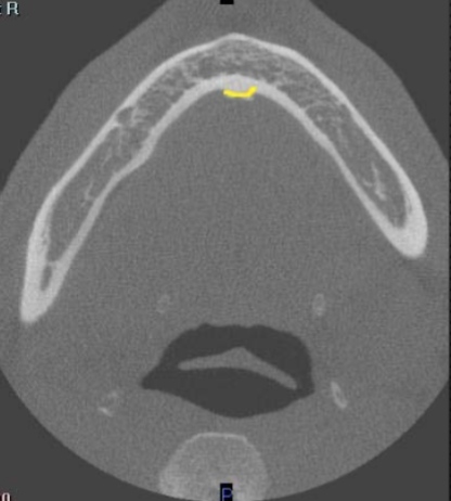 <p>identify structure </p>