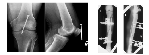 <p><span>Positioning Rules and Principles</span></p>