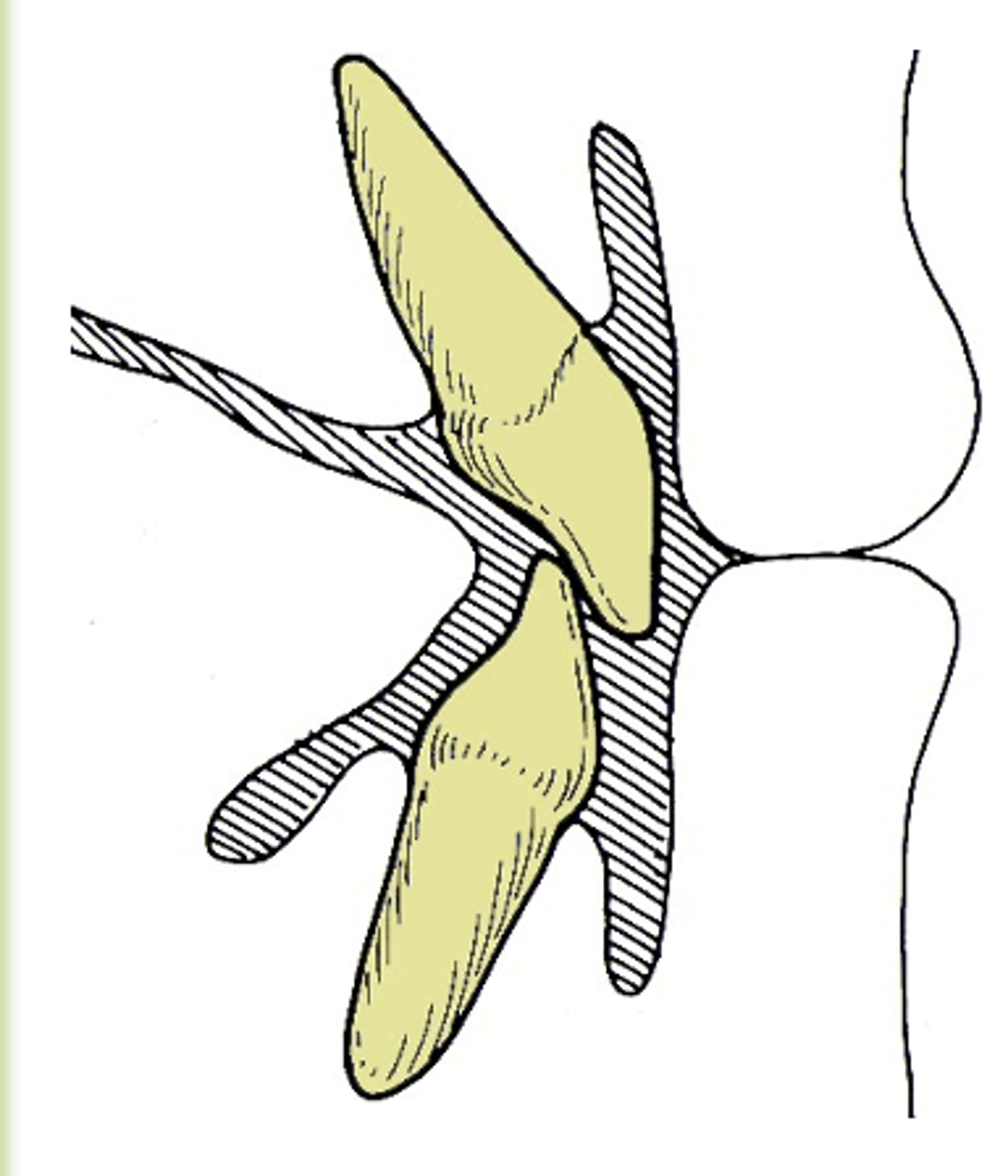 <p>What muscle is indicated in grey, posterior to the maxillary incisor?</p>
