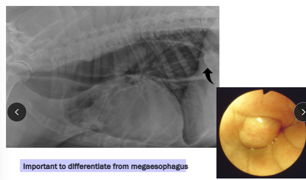 <ul><li><p><strong><u>Sarcoma</u>:</strong> Spirocerca lupi</p></li><li><p><strong><u>Squamous cell carcinoma</u></strong>: old cats</p></li><li><p><strong><u>Leiomyoma/sarcoma</u></strong>: dilated esophagus of dogs</p></li><li><p><span style="color: red;"><strong><u>CS</u></strong></span><strong><u>: </u></strong>Asymptomatic (early)</p><ul><li><p>Obstruction (advanced)</p></li></ul></li><li><p><span style="color: red;"><strong><u>TX:</u></strong></span> Surgical resection (distal leiomyoma)</p><ul><li><p>prognosis guarded <u>except: Leiomyoma</u></p></li></ul></li></ul><p></p>