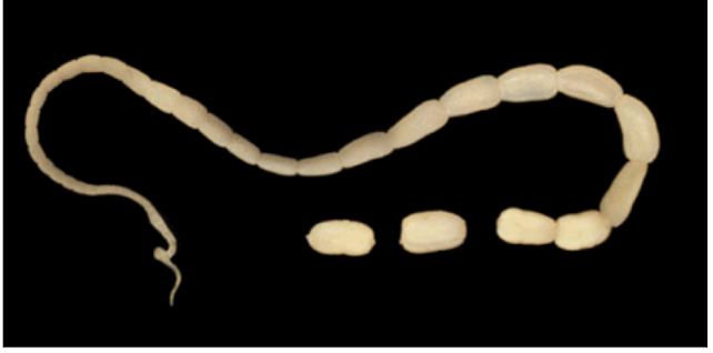 <p>long, ribbonlike arrangements (tapeworm)</p>