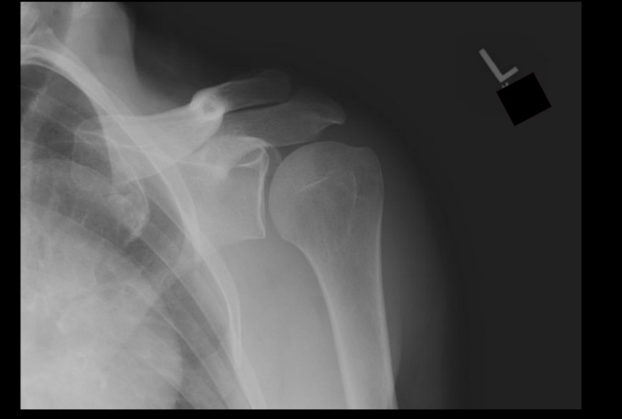 <p>What projection position is this image?</p>