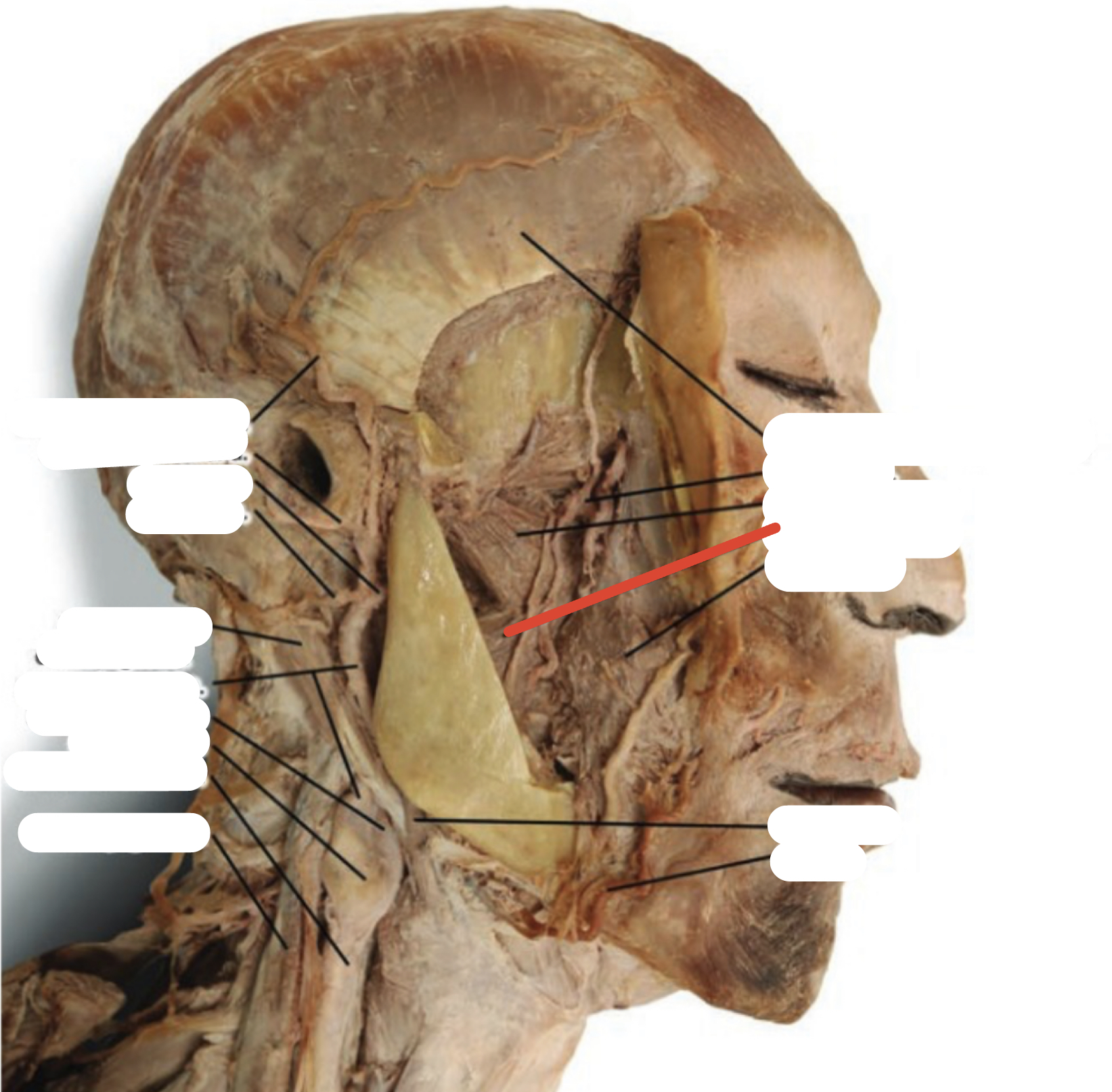 Identify the structure (red line)