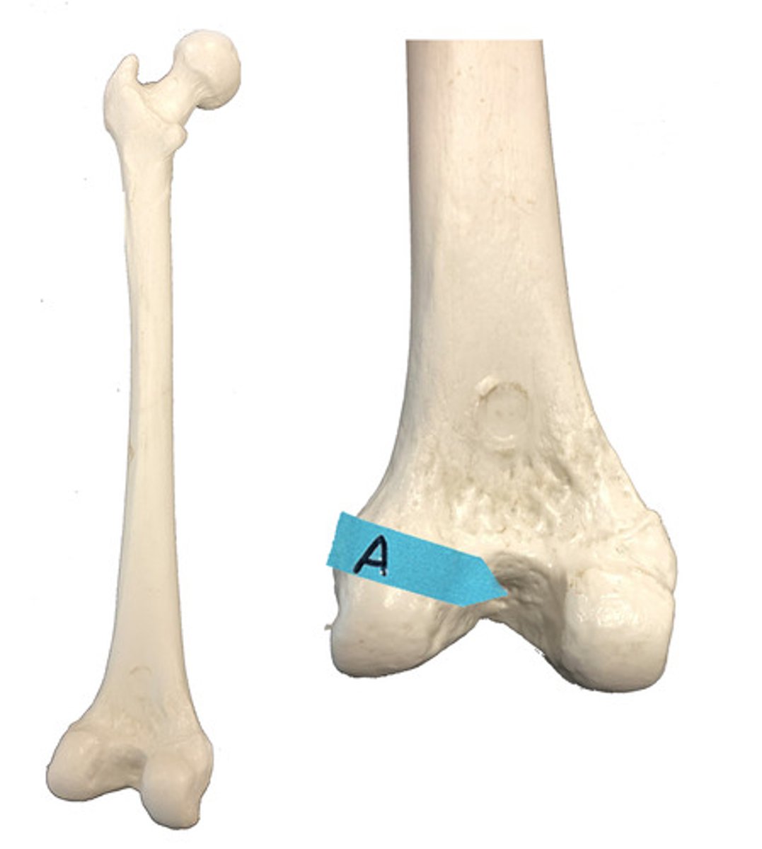 <p>Identify this bone marking.</p>