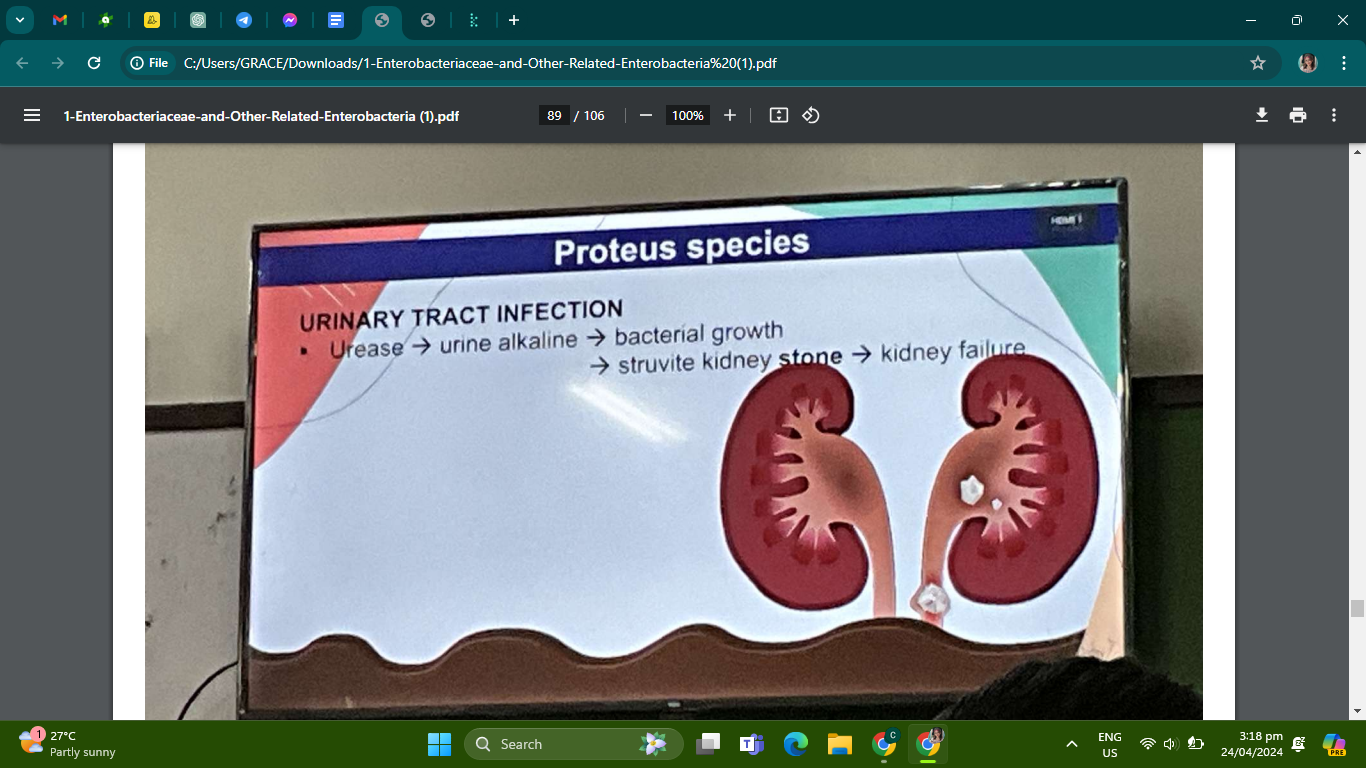 <p>In UTI, they produce urease that hydrolyzes urea in urine to ammonia and ammonium carbonate making the urine alkaline, thus favoring bacterial growth; and, because acidification is virtually impossible, this results in the formation struvite kidney stones (or calculi) that can cause an obstruction and leads to kidney failure.</p>