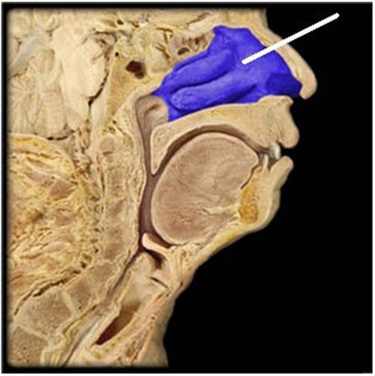 <p>Which structure is highlighted (reference leader line)?</p><p>A) soft palate</p><p>B) oropharynx</p><p>C) uvula</p><p>D) hard palate</p><p>E) nasal cavity</p>