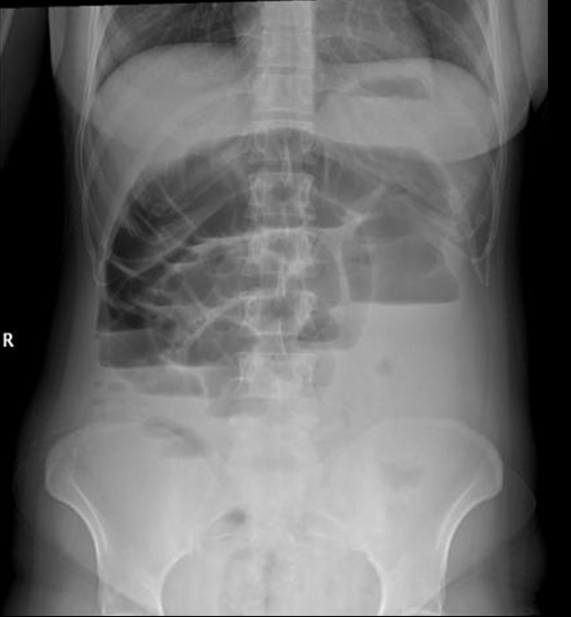 <p>What pathology is this?</p>