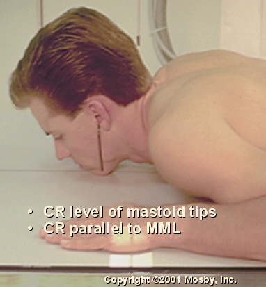 <p>What position is this?</p>