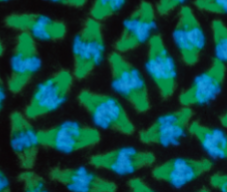 <p>fluorescence microscopy</p>