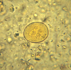 <p>Professor: Dr. Glena Fe A. Yapchulay-Alcabasa</p>