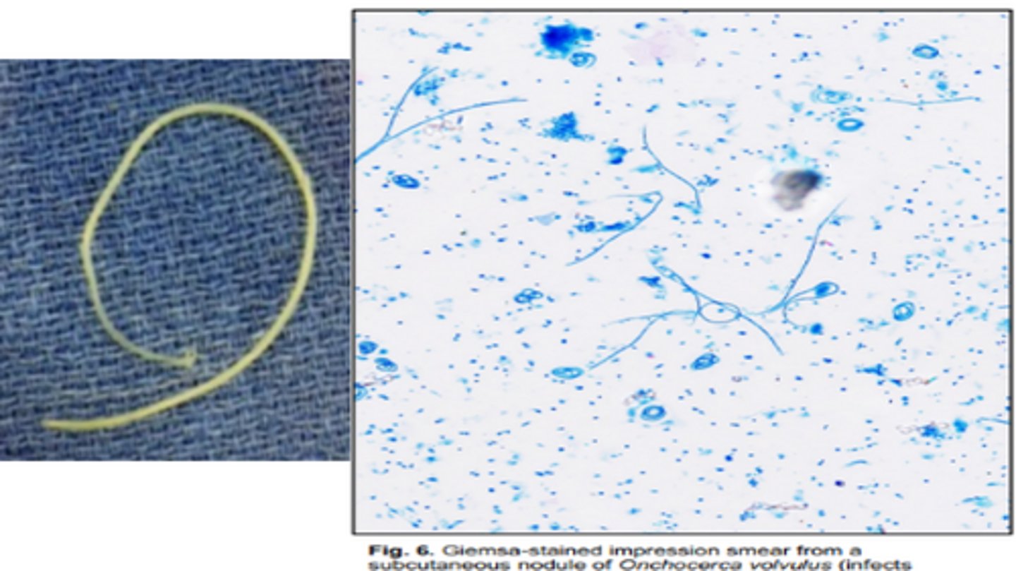 <p>Filiariid in equine whose microfiliariae can be found in the ocular conjunctiva, dermis, & connective tissues</p>