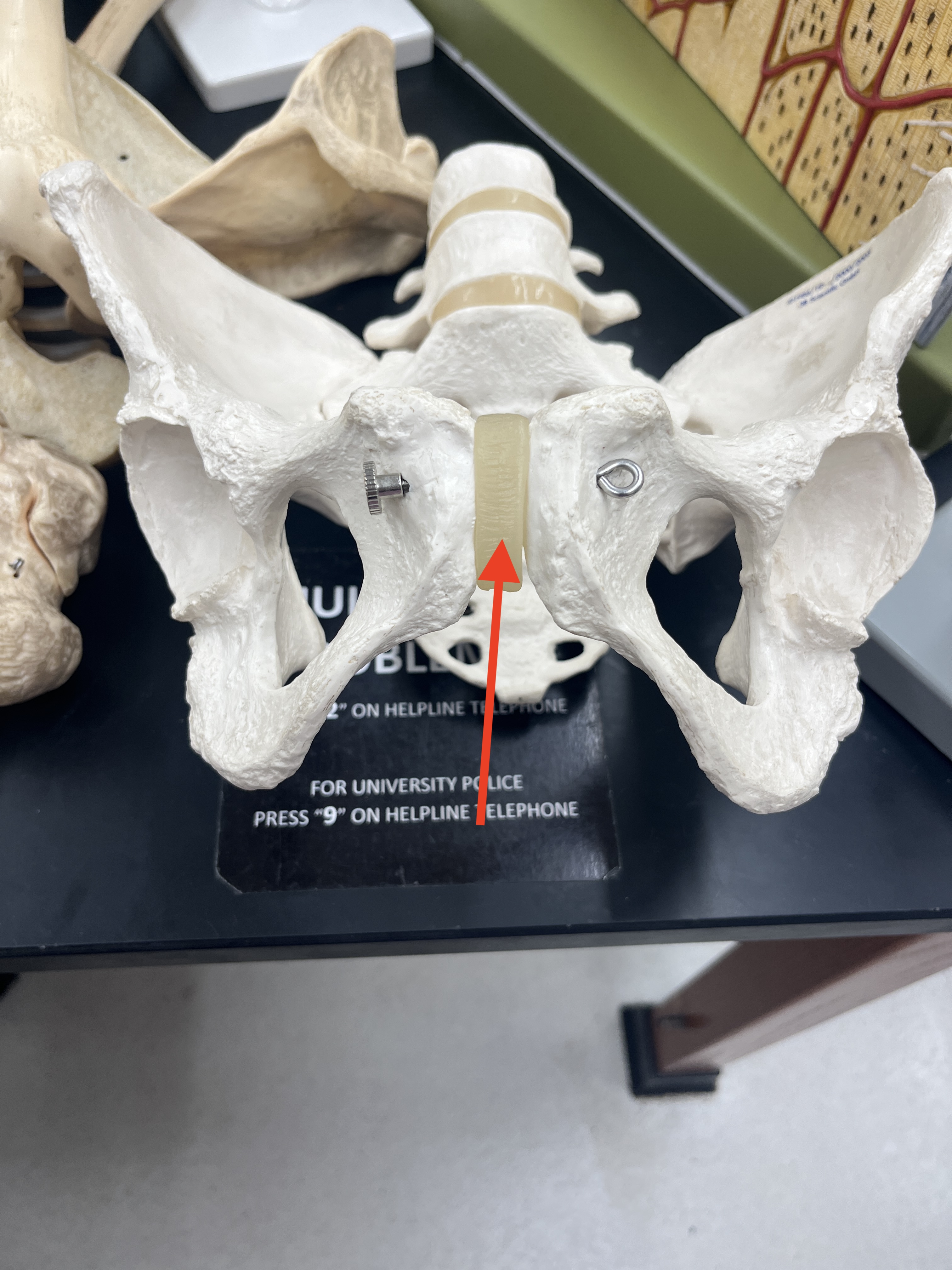 term image