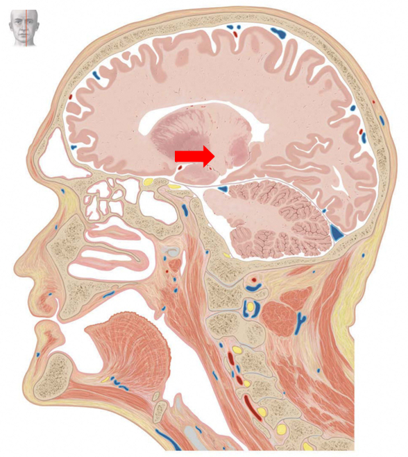 term image