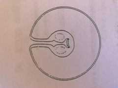 <p>What metacestode form is this? It consists of a single bladder with one scolex</p>