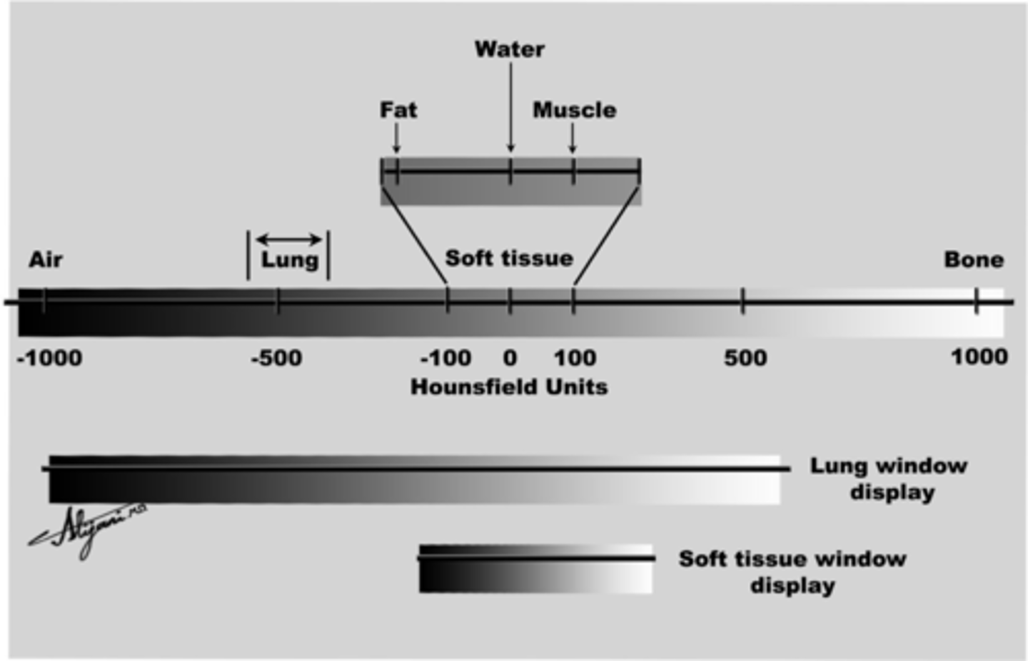 <p>Hounsfield Scale</p>