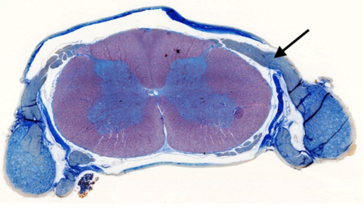 <p>Identify the part of the spinal cord</p>