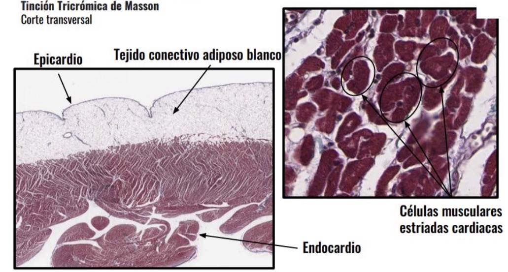 <p>Tejido muscular cardíaco </p>