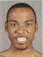 <p>What muscles make this expression?</p>