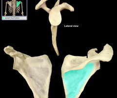 Shallow, basinlike depression in a bone, often serving as an articular surface