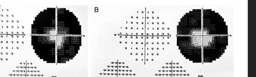 <p>What is this VF plot showing</p>