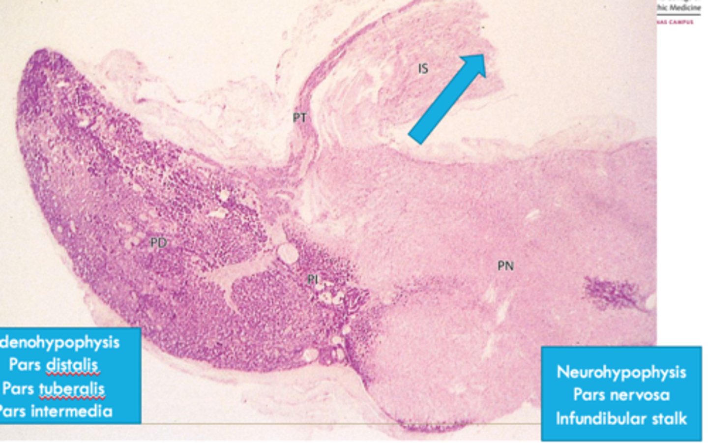 <p>ID dark-stained tissue</p>