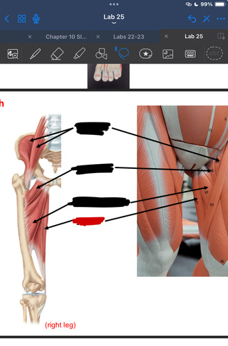 <p>What muscle is this?</p>