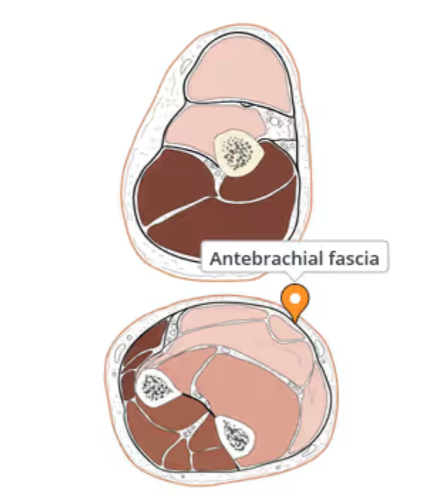 <p>Fascia of the thoracic limb which covers the muscles of the forearm. It follows the brachial fascia at the elbow joint and is continues by the dorsal fascia and palmar fascia of the hand at the carpal joint. </p>