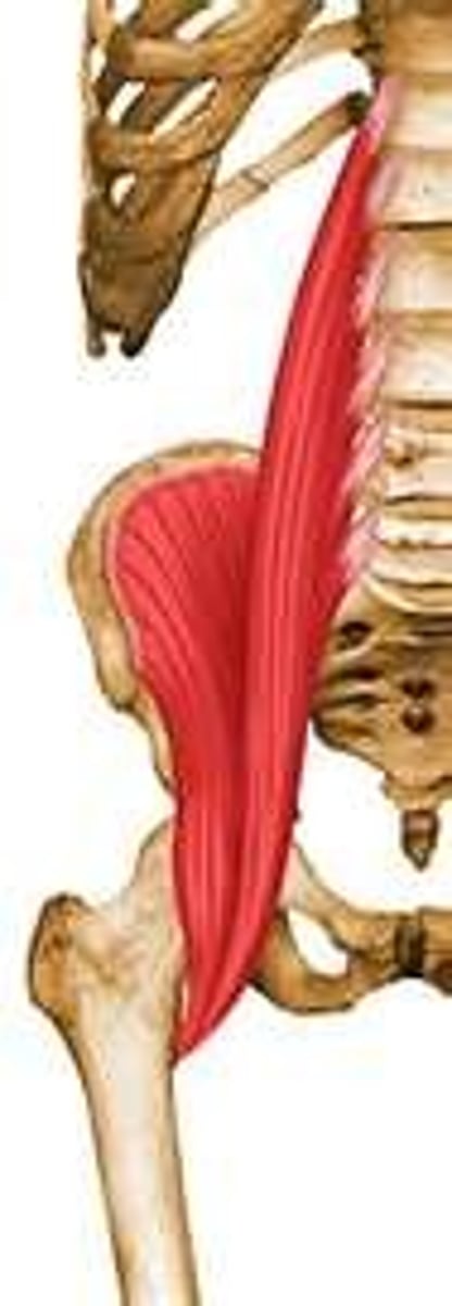 <p>Flexes hip</p>