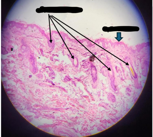 <p><span>How to identify?</span></p>