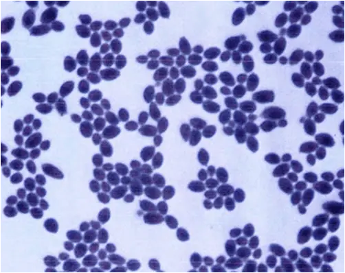 <p>How would you report this stain?</p>