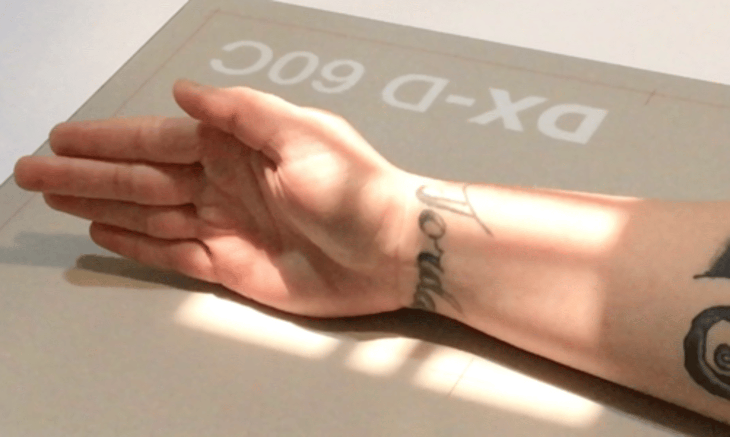 <p>Pt Placement: Arm extended in lateral position with pinky touching film, take pen to straighten out wrist</p><p>Collimation: part size</p><p>CR Placement: middle of part, scaphoid, proximal row of carpals</p><p>Tube tilt: none</p><p>SID: 40" tabletop</p><p>Breathing: DBDM</p>