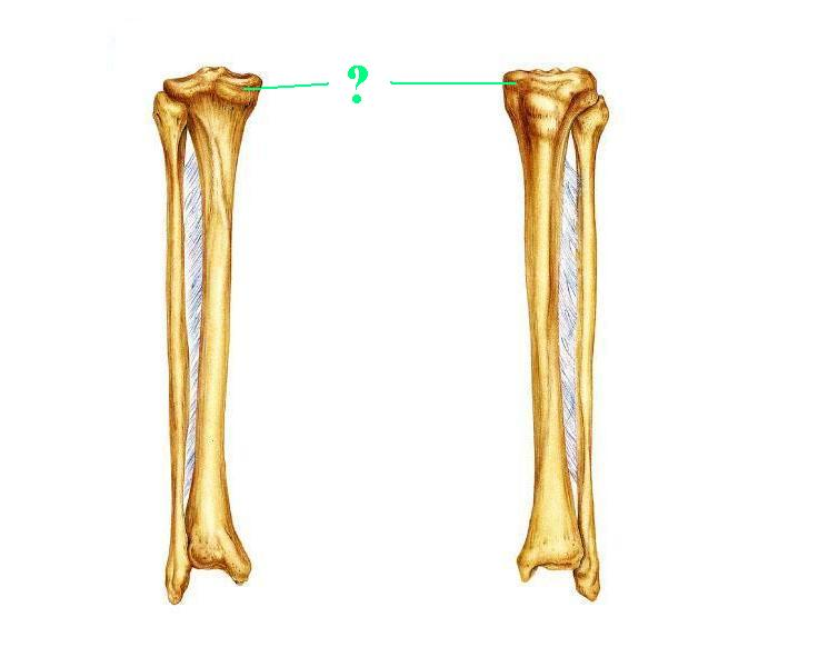 <p>Identify the indicated bone marking (projection)</p>