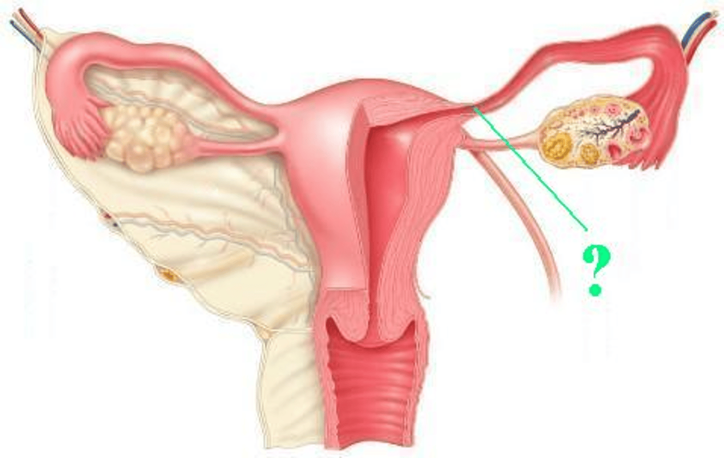 <p>Identify the indicated region of the uterine tube.</p>