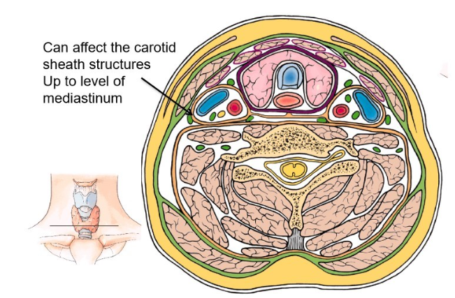 <p>immediately lateral to the  oro and nasopharynx </p>