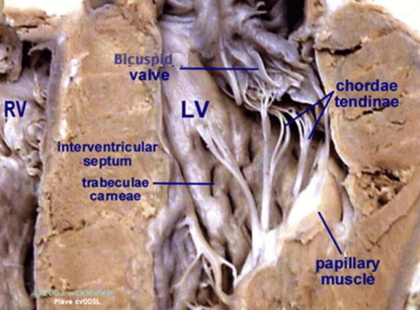 <p>prevents inversion or prolapse of AV valves during heart contraction</p>