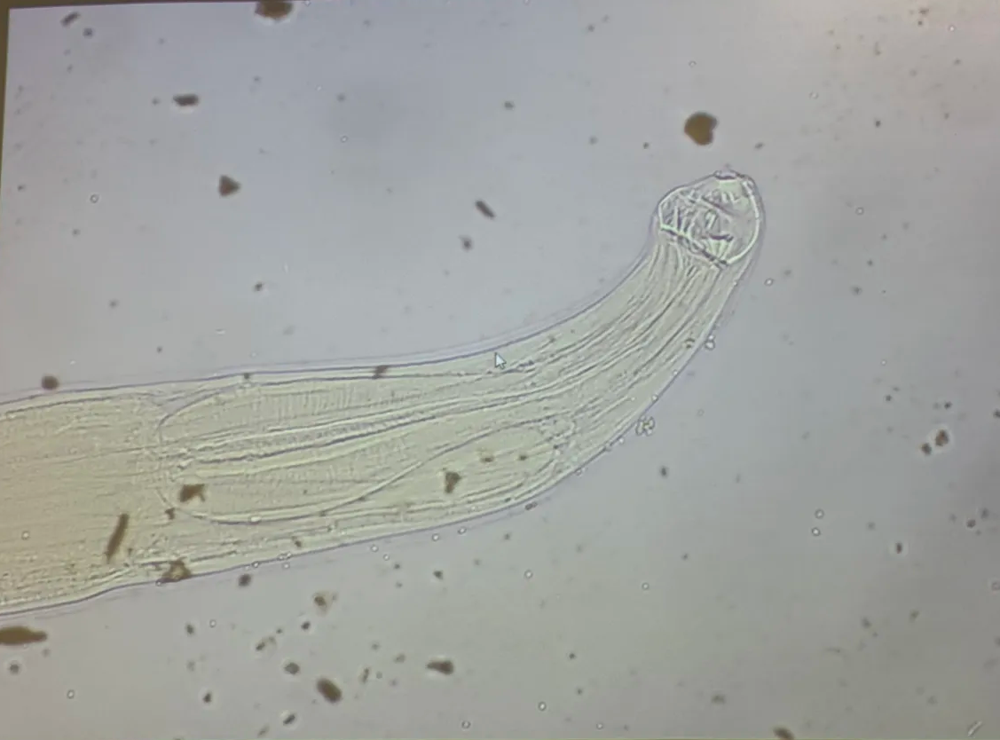 <p>in human</p><p>red serpiginous tracks</p>