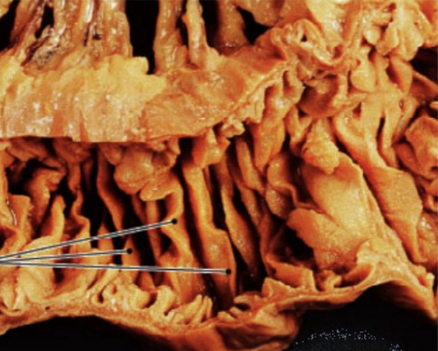 <ul><li><p>deep folds of submucosa</p></li><li><p>increase surface area for digestion and absorption</p></li><li><p>do NOT disappear as intestine expands (unlike gastric rugae)</p></li></ul><p></p>
