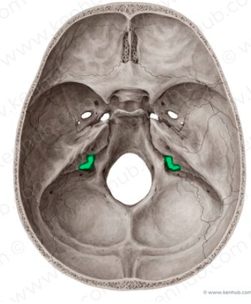 term image