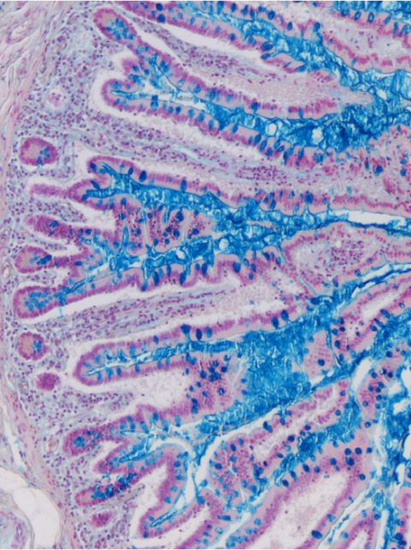<p>Less specific than AB but more sensitive</p>