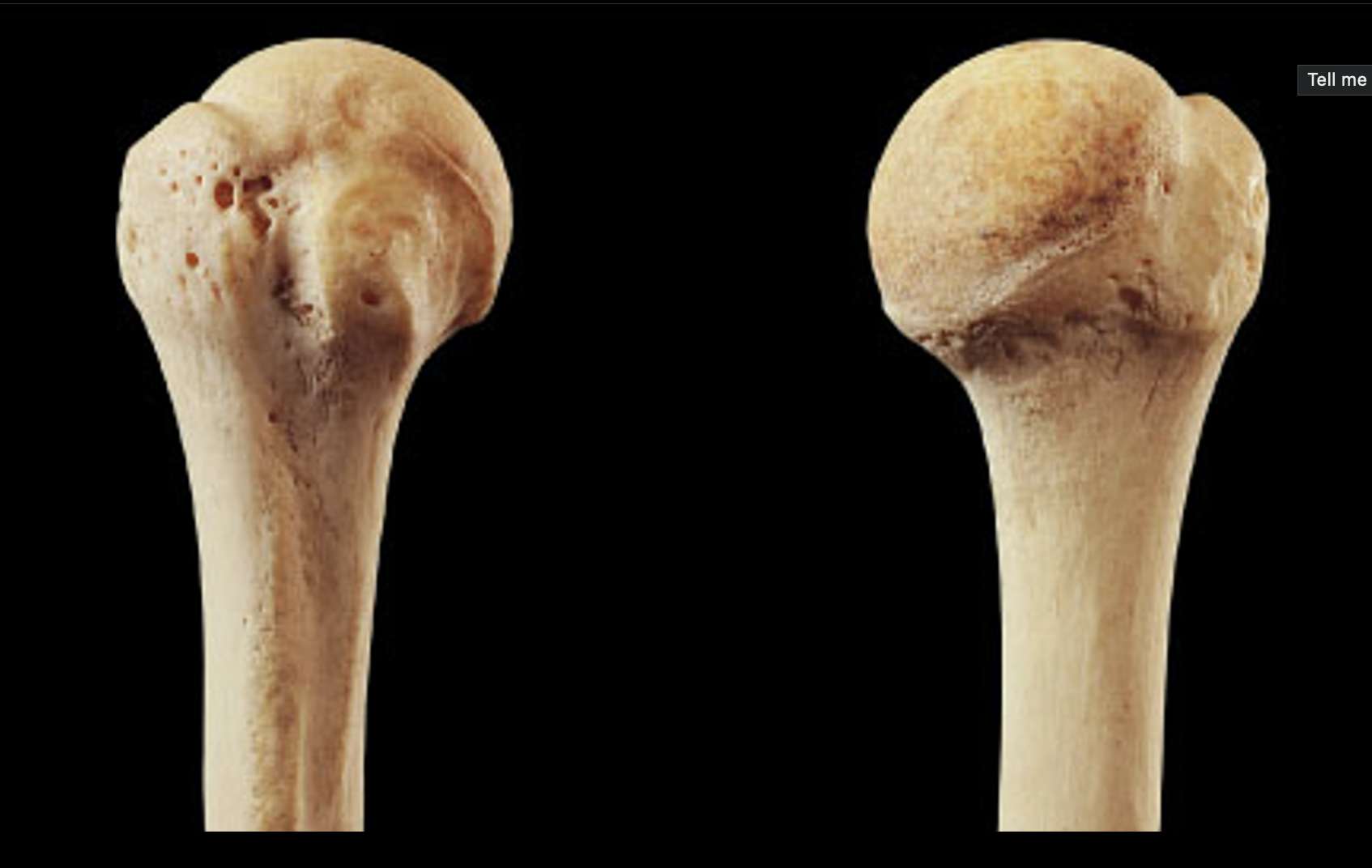 <p>Name this bone</p>