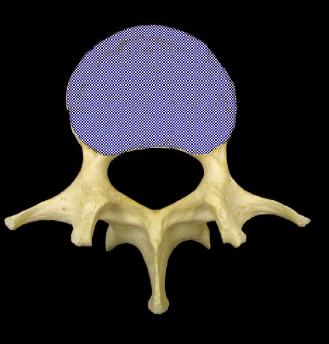 <p>the thick, disc-shaped anterior portion, which is the weight-bearing portion.</p>