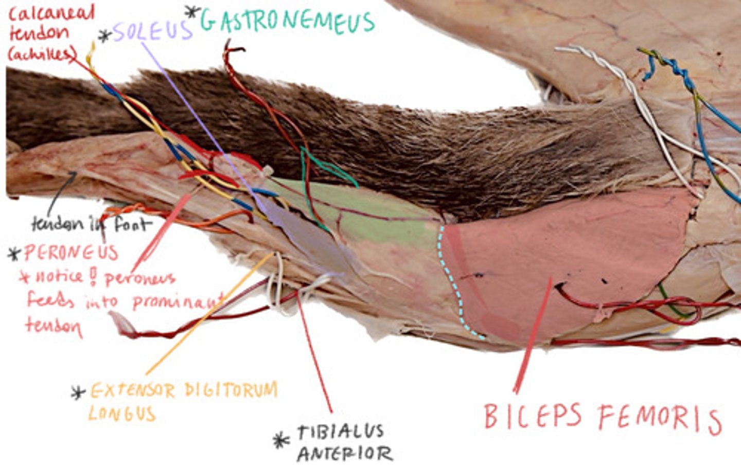 <p>Most lateral on leg</p>
