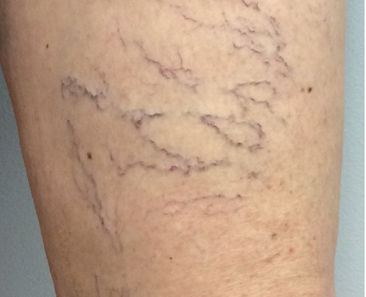 <p><span>Which is the best term to define veins in this image?&nbsp;</span></p>